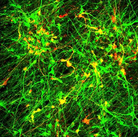 Fluorescence micrograph of cultured neurons